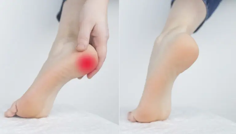 chiropractor for plantar fasciitis oshawa